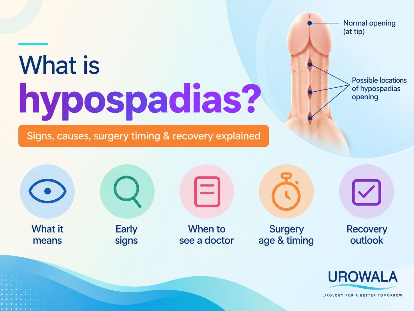 Hypospadias treatment in Jaipur by Dr Mohit Sharma
